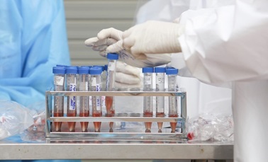 Quang Ngai was supported with 10,000 chemical test kits for SARS-CoV-2 virus
